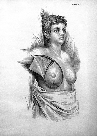Surgical papers / by William Steward Halsted.