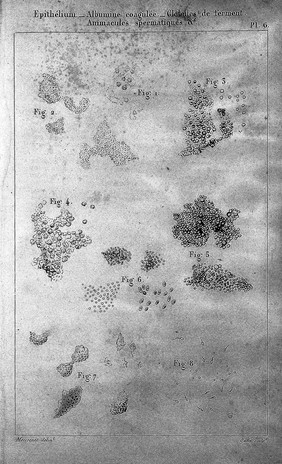 Traité des maladies des reins et des altérations de la sécrétion urinaire, étudiées en elles-mêmes et dans leurs rapports avec les maladies des uretères, de la vessie, de la prostate, de l'urèthre, etc. Avec un atlas in-folio / par P. Rayer ... Tome premier-[troisième].