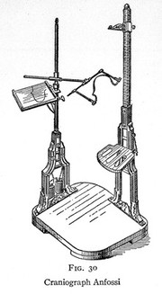 Craniograph anfossi from C. Lombroso's Criminal man