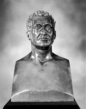 Guillaume Dupuytren, Baron Dupuytren. Bronze by A. Desboeufs, 1835.