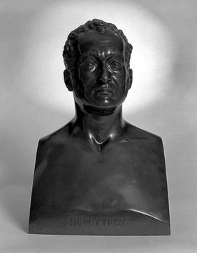 Guillaume Dupuytren, Baron Dupuytren. Bronze by A. Desboeufs, 1835.