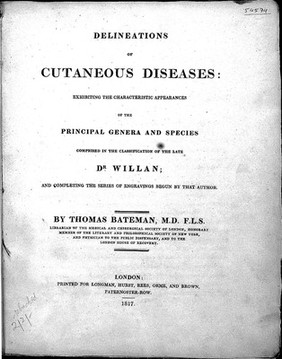 Dissertatio medica inauguralis de haemorrhoea petechiali / [Thomas Bateman].