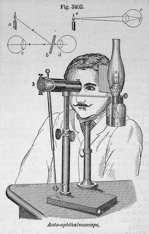 view E. Knight, Dictionary of mechanics: ophthalmoscope