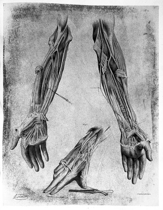 The anatomy of the arteries of the human body and its applications to pathology and operative surgery with a series of lithographic drawings / / by Richard Quain. The drawings from nature and on stone by Joseph Maclise.