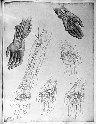 The anatomy of the arteries of the human body and its applications to pathology and operative surgery with a series of lithographic drawings / / by Richard Quain. The drawings from nature and on stone by Joseph Maclise.