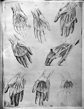 The anatomy of the arteries of the human body and its applications to pathology and operative surgery with a series of lithographic drawings / / by Richard Quain. The drawings from nature and on stone by Joseph Maclise.