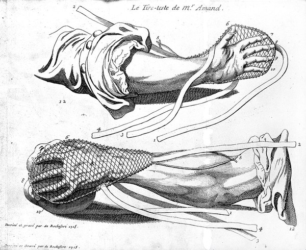 Nouvelles observations sur la pratique des accouchemens. Avec la maniere de se servir d'une nouvelle machine, tres-commode & facile, pour tirer promptement & surement, la tête de l'enfant, separée de son corps, & restée seule dans la matrice, sans se servir d'aucuns instrumens trenchans, ou piquans, qui puissent exposer la mere à aucun danger ... / [Pierre Amand].