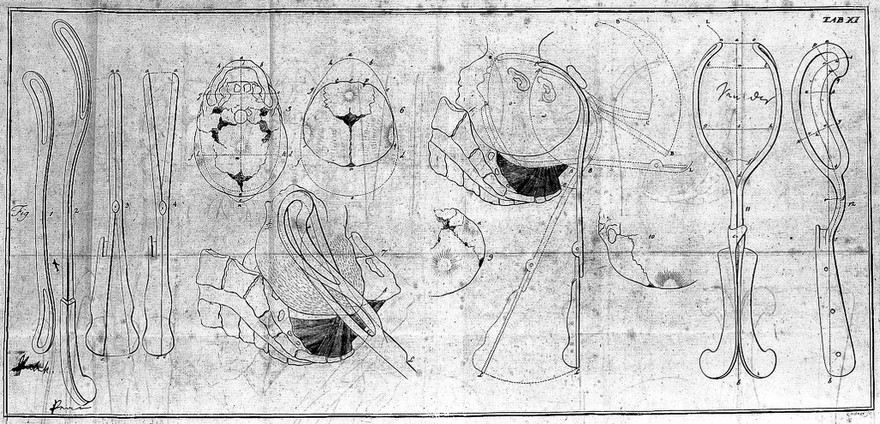 Litterärische und kritische Geschichte der Zangen und Hebel in der Geburtshülfe / Johann Mulders; Aus dem Lateinischen übersezt und mit einigen Anmerkungen versehen von Johann Willhelm [sic] Schlegel.