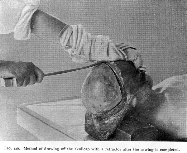 Post-mortem pathology : a manual of post-mortem examinations and the interpretations to be drawn therefrom a practical treatise for students and practitioners / by Henry W. Cattell.