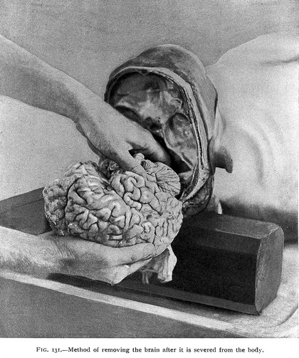 Post-mortem pathology : a manual of post-mortem examinations and the interpretations to be drawn therefrom a practical treatise for students and practitioners / by Henry W. Cattell.