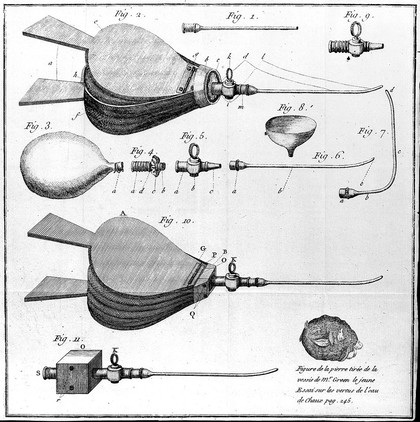Essai sur les vertus de l'eau de chaux, pour la guérison de la pierre. Avec ... l'histoire de la maladie de M. Walpole ... celle ... de M. Newcome, etc / Traduit sur la 2e éd. de l'anglois, par A. Roux. Anquel on ajouté une méthode de dissoudre la pierre par la voie des injections de M. Butter, traduit par le mème.