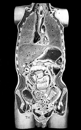 Topographisch-chirurgische Anatomie des Menschen / von Dr. Rüdinger.