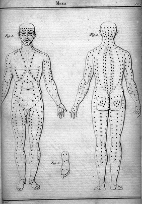 Recueil de mémoires de chirurgie / par le baron D.J. Larrey.