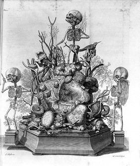 Opera omnia anatomico-medico-chirurgica, hucusque edita / [Frederik Ruysch].