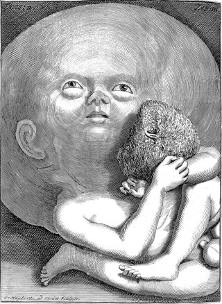 Opera omnia anatomico-medico-chirurgica, hucusque edita / [Frederik Ruysch].
