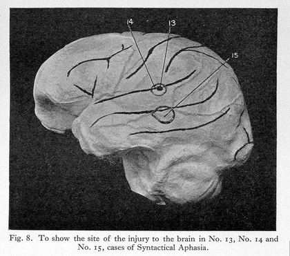 Aphasia and kindred disorders of speech / by Henry Head.