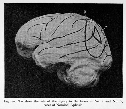 Aphasia and kindred disorders of speech / by Henry Head.