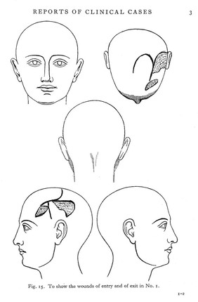 Aphasia and kindred disorders of speech / by Henry Head.