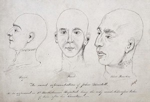 view The head of John Thurtell after his hanging. Pen drawing by J. Wentzell, 1824.