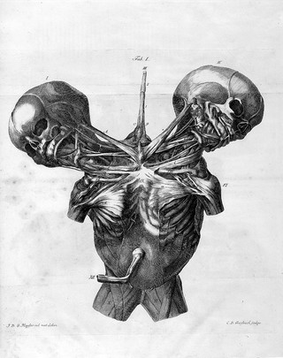 De duplicitate monstrosa commentarius / Quem conscripsit Joannes Fridericus Meckel.