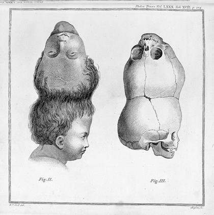 An account of a child with a double head / [Sir Everard Home].
