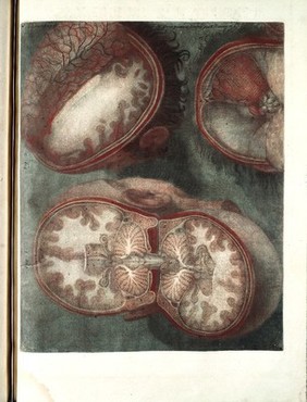 Anatomie de la tête, en tableaux imprimés, qui representent au naturel le cerveau sous différentes coupes, la distribution des vaisseaux ... les organes des sens, et une partie de la névrologie, d'après les pièces disséquées et préparées / par Duverney.