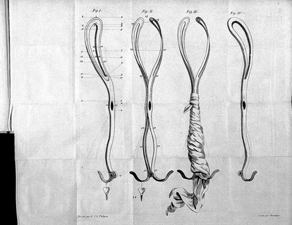 Nouveau forceps non croisé, ou, Forceps du célèbre Levret perfectionné en 1781 : avec la manière de s'en servir / Par Jean-Simon Thénance.