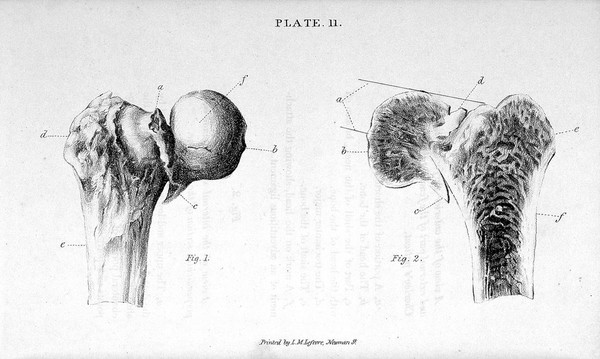 Practical remarks on the nature and treatment of fractures of the trunk and extremities. Being the substance of that portion of his lectures which relates to this subject ... / By Joseph Amesbury.