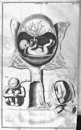 The anatomy of human bodies. Comprehending the most modern discoveries and curiosities in that art. To which is added a particular treatise of the small-pox and measles. Together with several practical observations and experienced cures. With 139 figures curiously cut in copper, representing the several parts and operations. Written in Latin by Isbrand de Diemerbroeck ... Translated from the last and most correct and full edition of the same / by William Salmon.