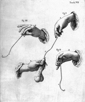 Litotomia; ovvero, del cavar la pietra ... / [Tommaso Alghisi].