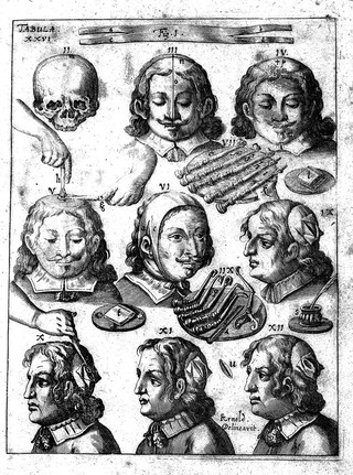 Armamentarium chirurgicum bipartitum / studioq́; & operâ D. Joannis Sculteti ... reformatum, correctum & auctum. Cum LVI. tabulis, sive figuris aeneis novis accuratissimis. Ut & tribus indicibus absolutissimis, instrumentorum scilicet, observationum, et rerum notabilium.