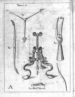 Armamentarium chirurgicum bipartitum / studioq́; & operâ D. Joannis Sculteti ... reformatum, correctum & auctum. Cum LVI. tabulis, sive figuris aeneis novis accuratissimis. Ut & tribus indicibus absolutissimis, instrumentorum scilicet, observationum, et rerum notabilium.