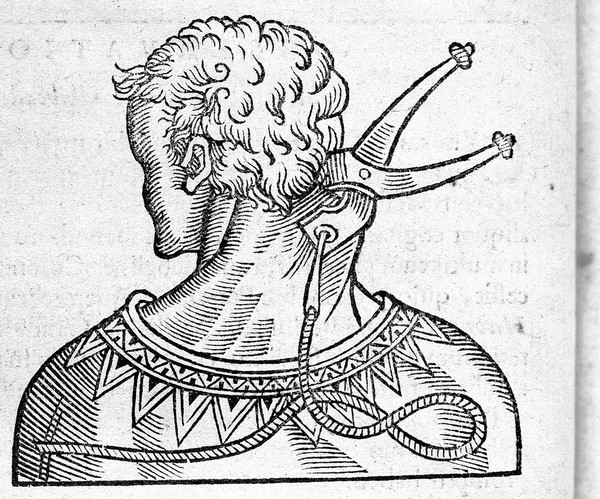 Guilhelmi Fabricii Hildani ... Observationum et curationum chirurgicarum centuriae, nunc primum in unum opus congestae, ac in duo volumina distributae. Quorum prius continet centurias I. II. & III / [Wilhelm Fabricius Hildanus].