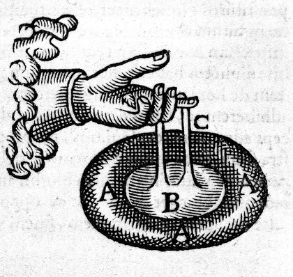 Guilhelmi Fabricii Hildani ... Observationum et curationum chirurgicarum centuriae, nunc primum in unum opus congestae, ac in duo volumina distributae. Quorum prius continet centurias I. II. & III / [Wilhelm Fabricius Hildanus].