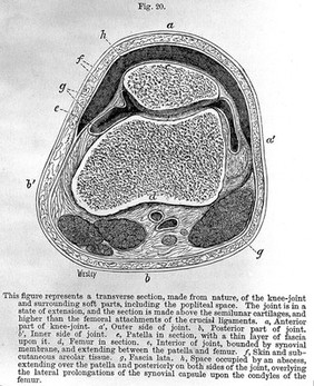 On rest and pain : a course of lectures on the influence of mechanical and physiological rest in the treatment of accidents and surgical diseases, and the diagnostic value of pain delivered at the Royal College of Surgeons of England in the years 1860, 1861, and 1862 / by John Hilton ; edited by W.H.A. Jacobson.