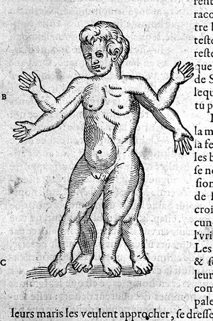 view A. Pare: "Oeuvres...", 1579: figure with four arms and legs