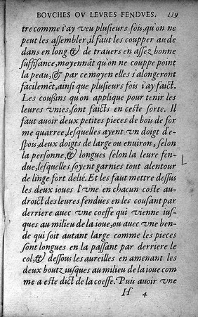 Petit traité contenant une des parties principalles de chirurgie, laquelle les chirurgiens hernières excercent. Ainsi quil est montre en la page suivante ... / [Pierre Franco].