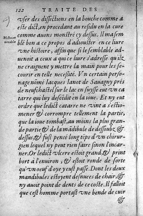 Petit traité contenant une des parties principalles de chirurgie, laquelle les chirurgiens hernières excercent. Ainsi quil est montre en la page suivante ... / [Pierre Franco].