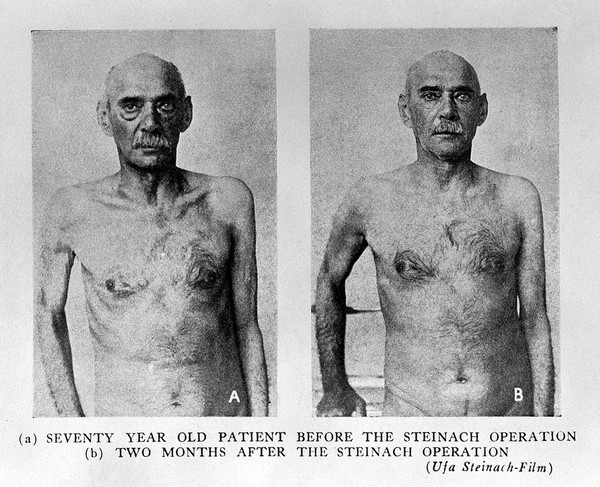 Rejuvenation and the prolongation of human efficiency : experiences with the Steinach-operation on man and animals / by Dr. Paul Kammerer, with an introduction by Dr. Harry Benjamin.