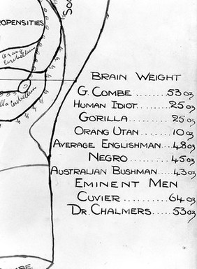 Phrenology: the human and animal brain, the location of its functions according to the principles of phrenology, and personalia of phrenologists. Photographs, drawings and newsletters.