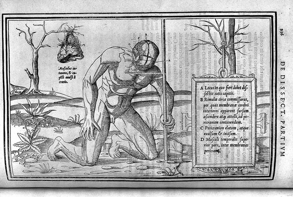 De dissectione partium corporis humani libri tres / à Carolo Stephano, ... Una cum figuris et incisionum declarationibus, a Stephano Riverio chirurgo compositis.