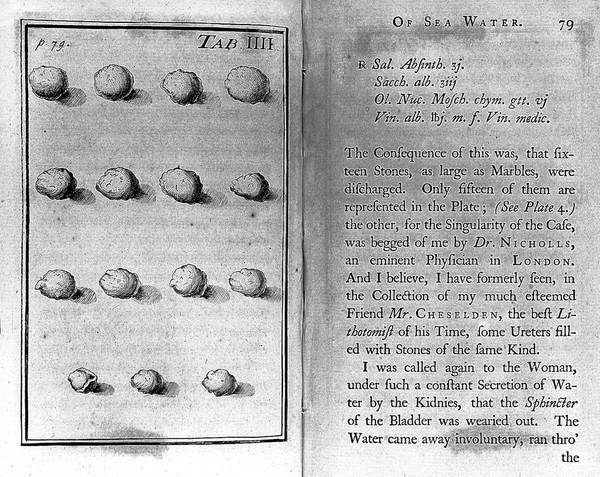 A dissertation on the use of sea-water in the diseases of the glands. Particularly the scurvy, jaudice, king's-evil, leprosy, and the glandular consumption / Translated from the Latin ... by an eminent physician.