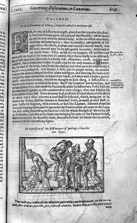 The workes of ... Ambrose Parey ... / Translated out of Latine and compared with the French. By Th. Johnson [and in part by George Baker].