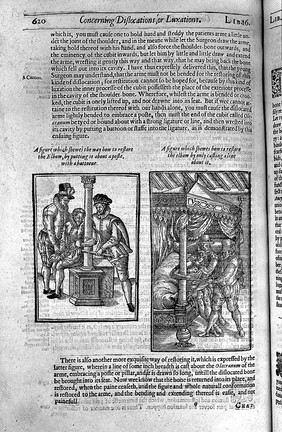 The workes of ... Ambrose Parey ... / Translated out of Latine and compared with the French. By Th. Johnson [and in part by George Baker].