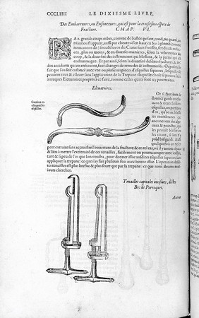 Les œuvres d'Ambroise Paré ... Diuisees en vingt huict liures, auec les figures et portraicts, tant de l'anatomie, que des instruments de chirurgie, et de plusieurs monstres. Reueuës et augmentees par l'autheur.