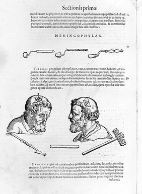 Chirurgiae ... libri septem, quamplurimis instrumentorum imaginibus arti chirurgicae opportunis suis locis exornata, theoricam, practicam, ac verissimam experientiam continentes ... Nunc primum in lucem editi ... / [Giovanni Andrea della Croce].