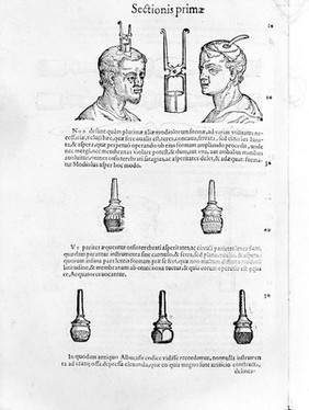 Chirurgiae ... libri septem, quamplurimis instrumentorum imaginibus arti chirurgicae opportunis suis locis exornata, theoricam, practicam, ac verissimam experientiam continentes ... Nunc primum in lucem editi ... / [Giovanni Andrea della Croce].