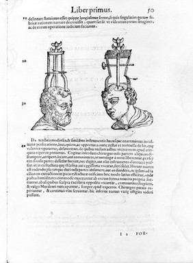 Chirurgiae ... libri septem, quamplurimis instrumentorum imaginibus arti chirurgicae opportunis suis locis exornata, theoricam, practicam, ac verissimam experientiam continentes ... Nunc primum in lucem editi ... / [Giovanni Andrea della Croce].