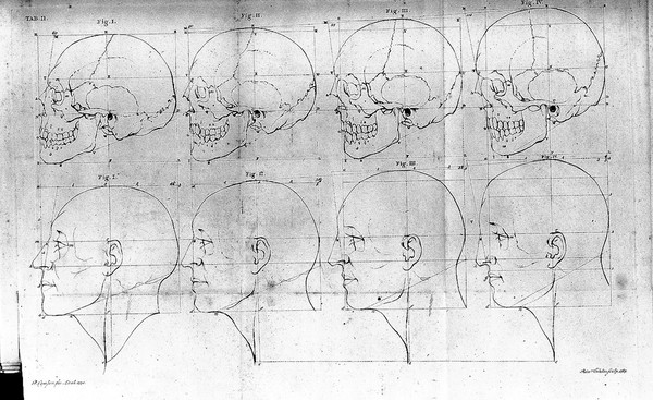 Discours / prononcés par feû Mr. Pierre Camper, en l'Académie de dessein d'Amsterdam, sur le moyen de représenter d'une manière sûre les diverses passions qui se manifestent sur le visage; sur l'étonnante conformité qui existe entre les quadrupèdes, les oiseaux, les poissons et l'homme; et enfin sur le beau physique: publiés par son fils Adrien Gilles Camper, traduits du hollandois par Denis Bernard Quatremere D'Isjonval.