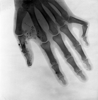 Bones of a hand. Radiograph, 1900/1904.